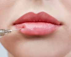 Tips On Making Your Botox Filler Last Longer