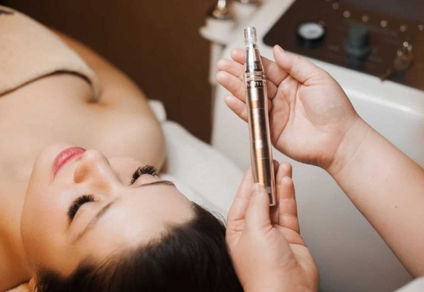 Learn About The Best Microneedling Pen For Hair Loss
